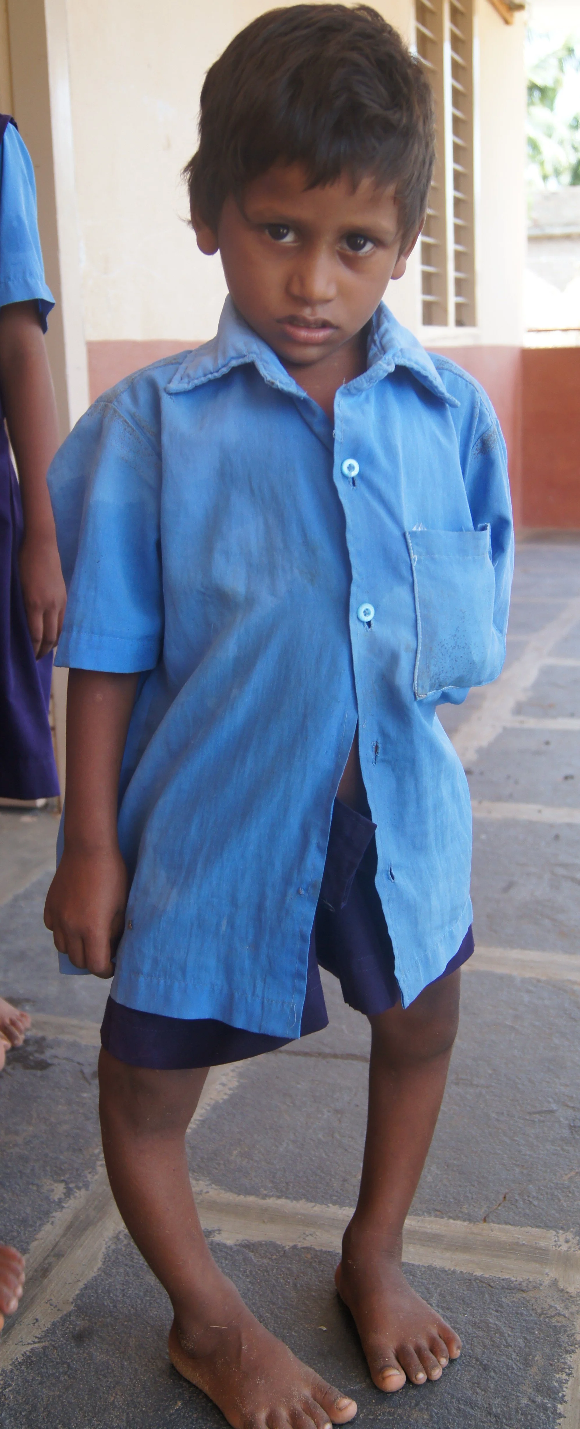 boy with a problem.JPG