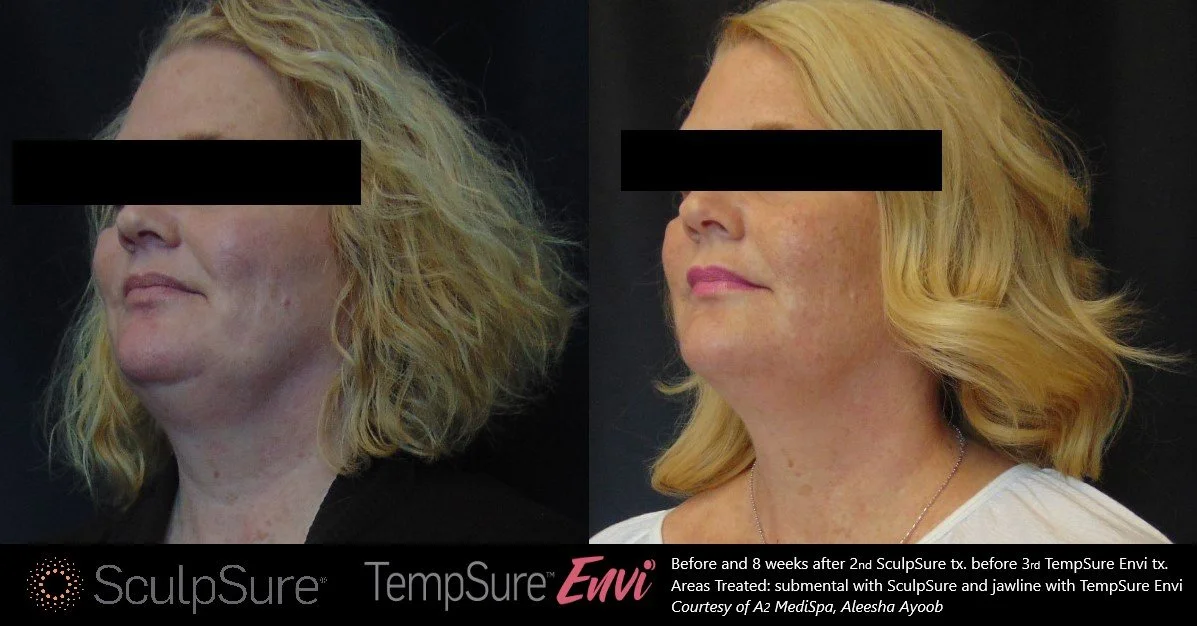 B&A cindy.jpg