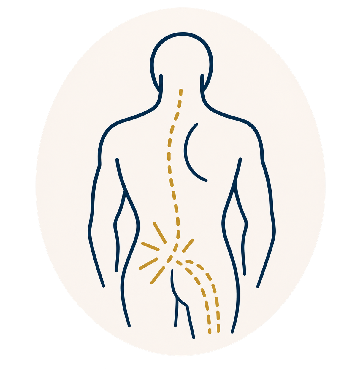 Illustration of a person experiencing low back pain and sciatica.png