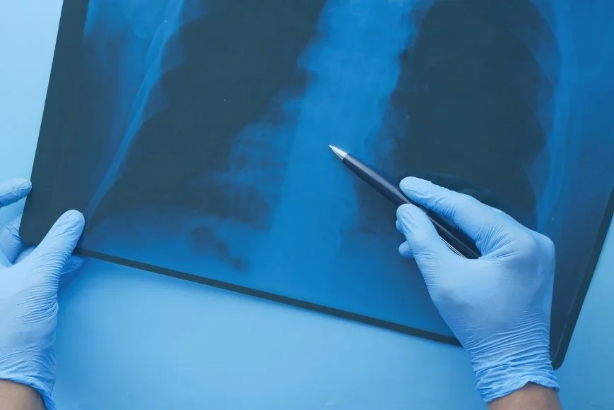 VO₂ Max Testing for Heart and Lung Health in West Houston