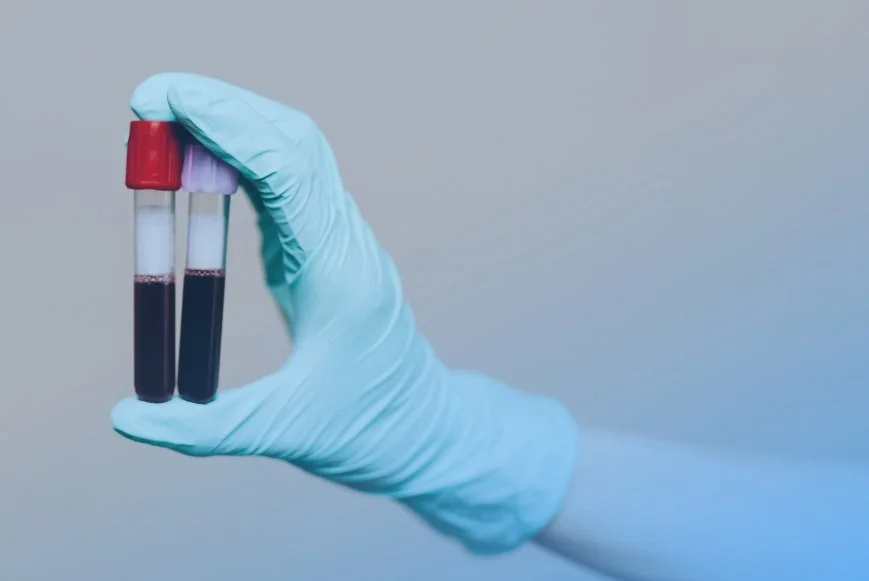 Understanding Your Health with Biomarker Testing