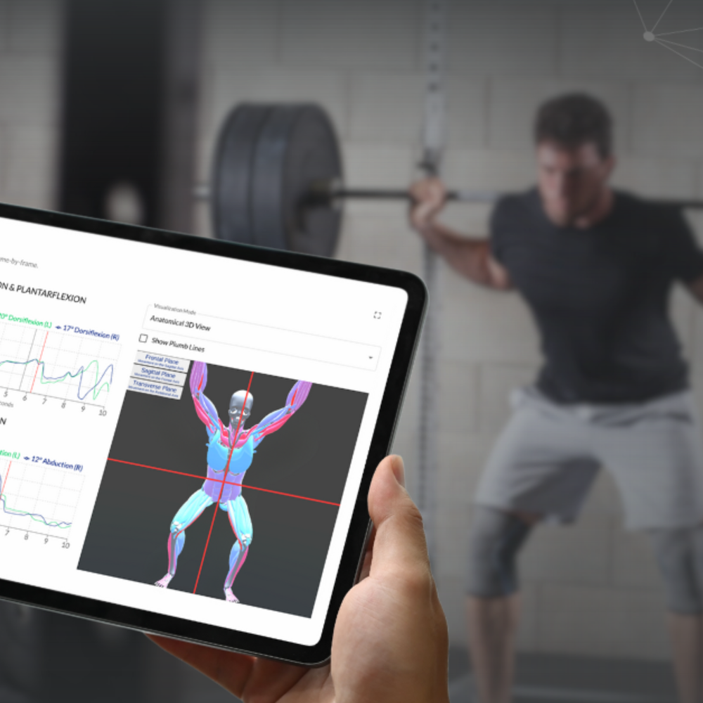 Kinotek | AI-Powered Movement Assessment — DexaFit West Houston