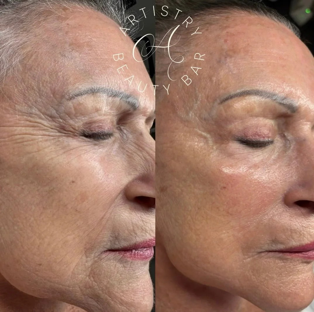 ✨ One facial. One treatment. A whole new glow.

This Glo2 Deluxe Facial + ExoFirm Pod delivers visible results in just one treatment&mdash;helping to smooth, firm, brighten, and rejuvenate the look of the skin while enhancing that fresh, lifted glow.