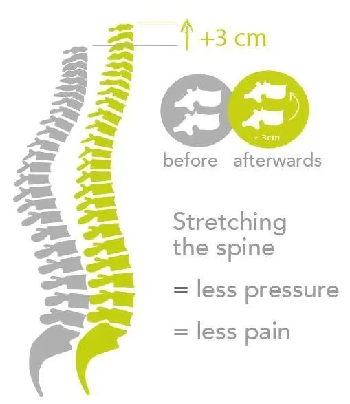 Illustration showing the effect of stretching the spine, which increases its length by 3 cm, resulting in less pressure and less pain.