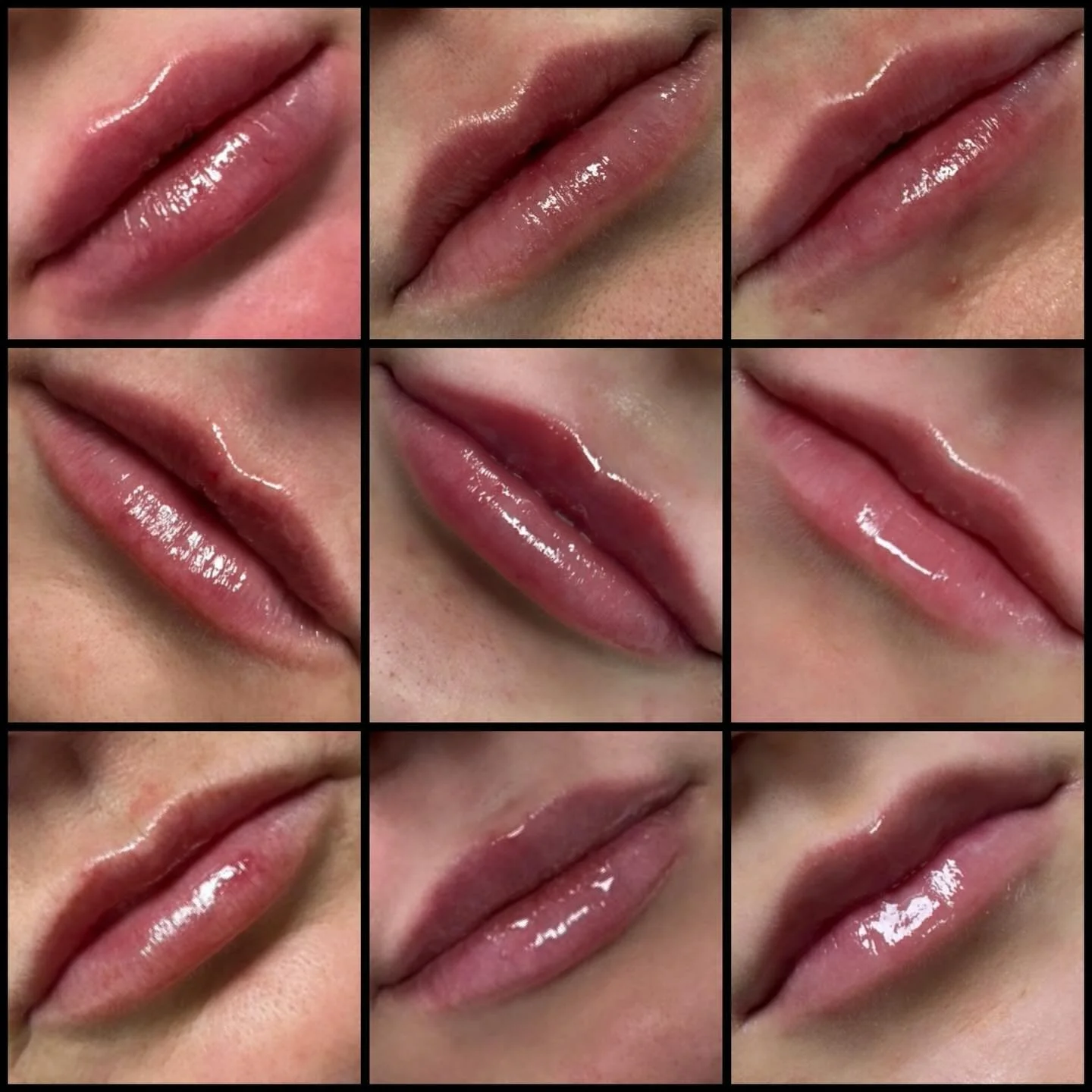 A few of my recents 💋
No two lips are the same, that&rsquo;s the beauty of it. Thoughtful enhancement, always.