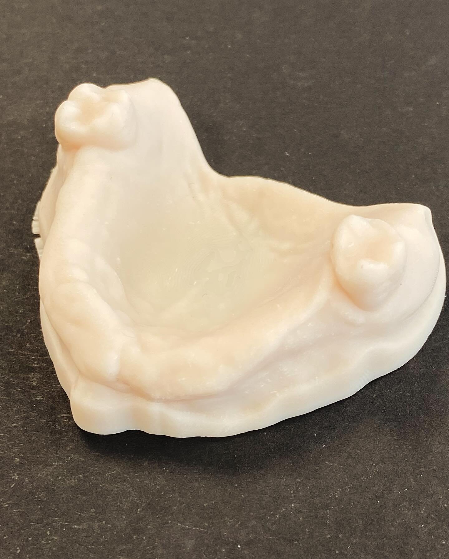 The start of a digitally produced denture.  The gums are &ldquo;scanned&rdquo; (3D photos), then converted to a try-in.  This is adjusted for for, comfort and looks before committing to the final denture.