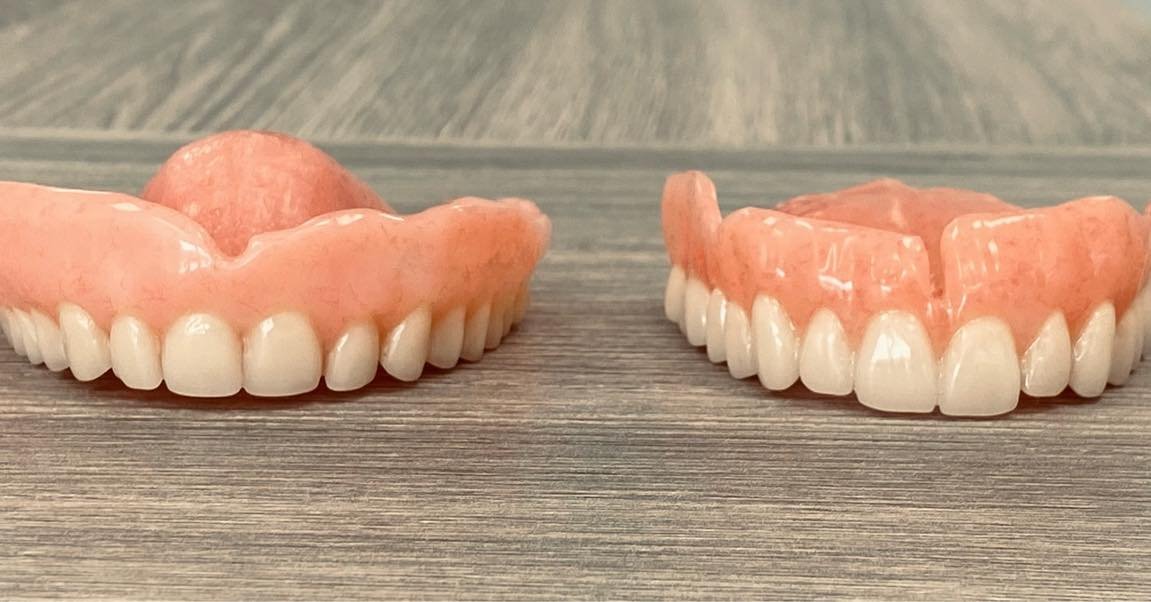 Dentures should look like teeth, right?  The denture on the left is an old-style denture.  The denture on the right is a Click Smart denture.  The difference is the attention to detail in choosing size, shape and tooth position (plus s some amazingly