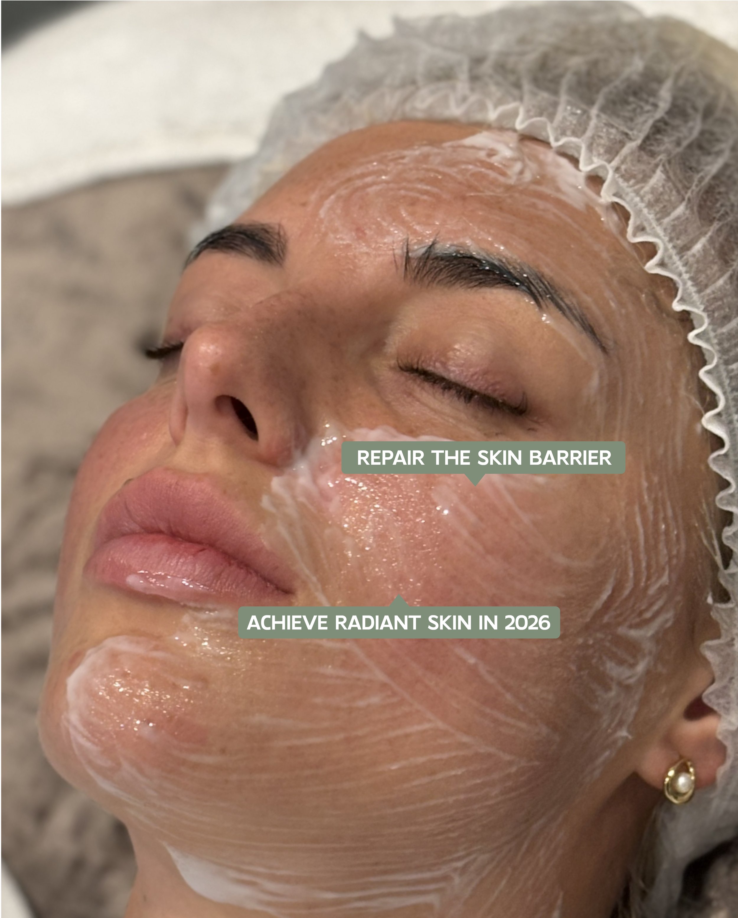 The Science of Winter Skin: How Advanced Treatments Repair the Skin Barrier