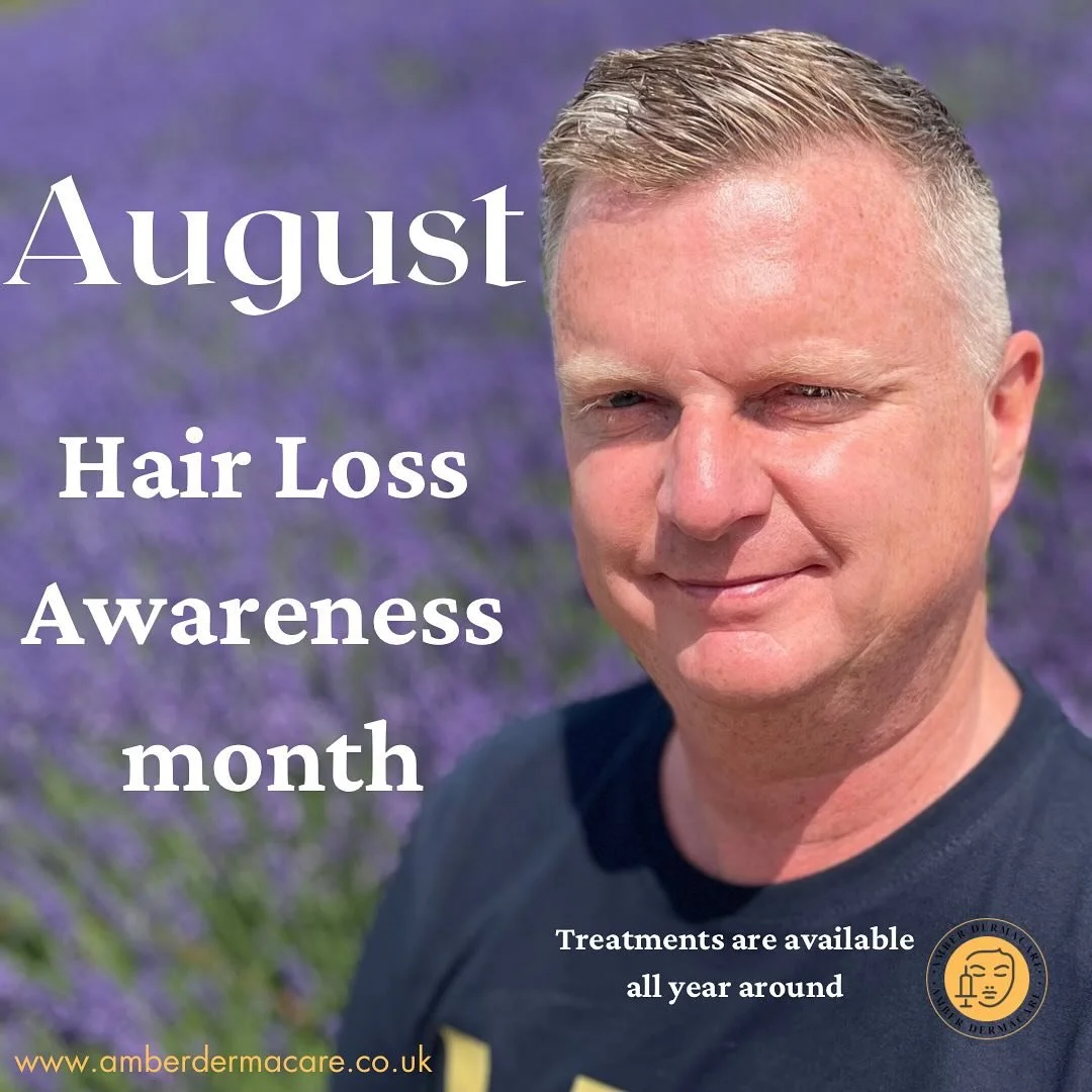 August might be coming to an end, but your hair care journey doesn&rsquo;t have to. Don&rsquo;t forget that treatments for hair loss are available all year round. It&rsquo;s never too late to take the next step in caring for your hair. Let&rsquo;s ke