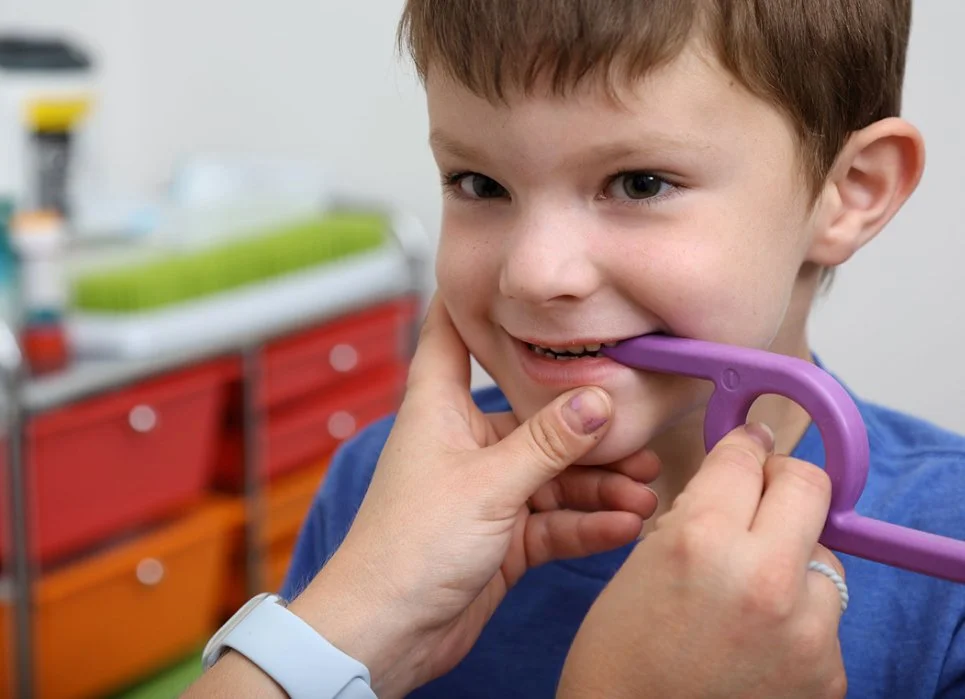 Tongue thrust therapy