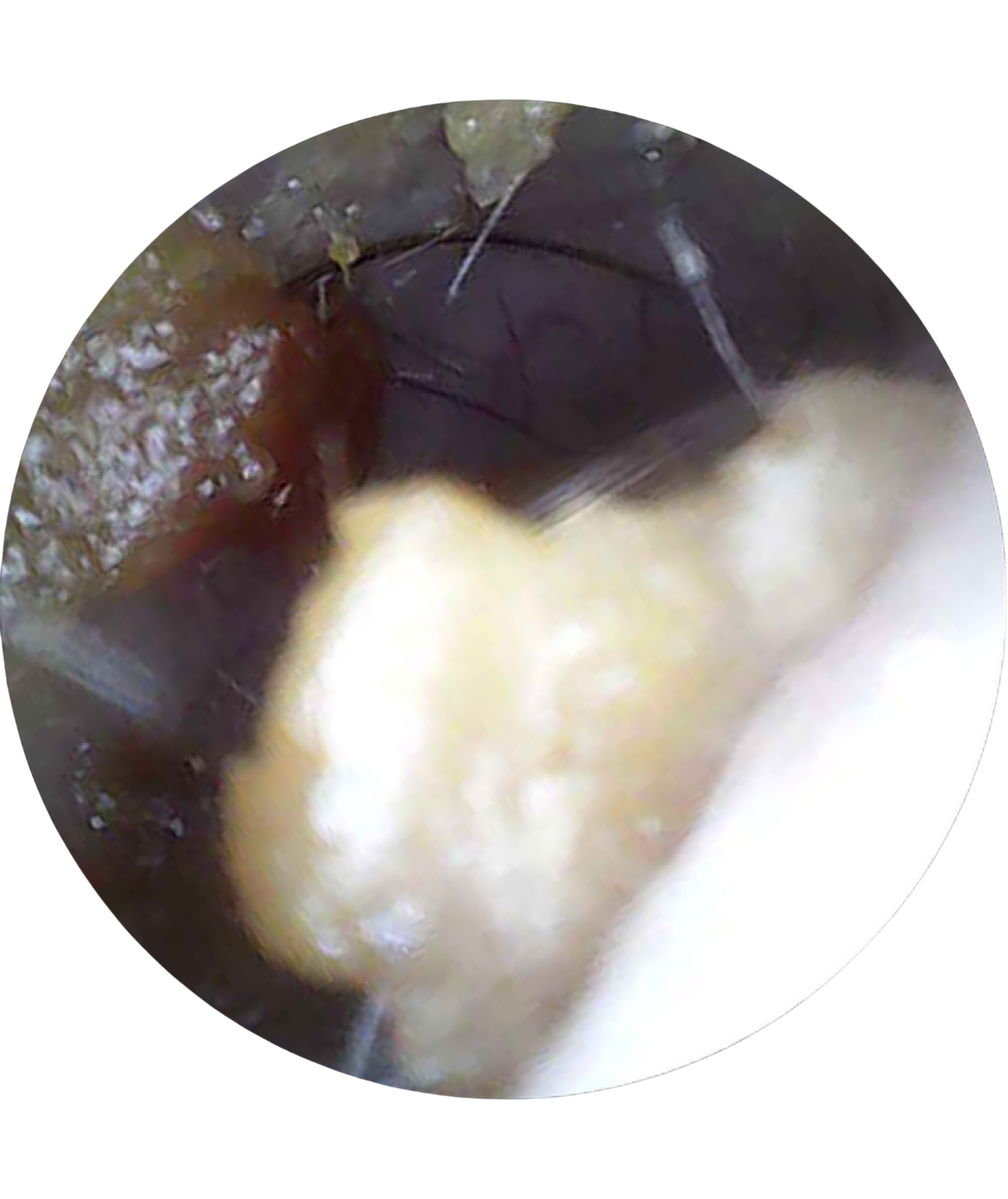 Inside Ear 2 White.png