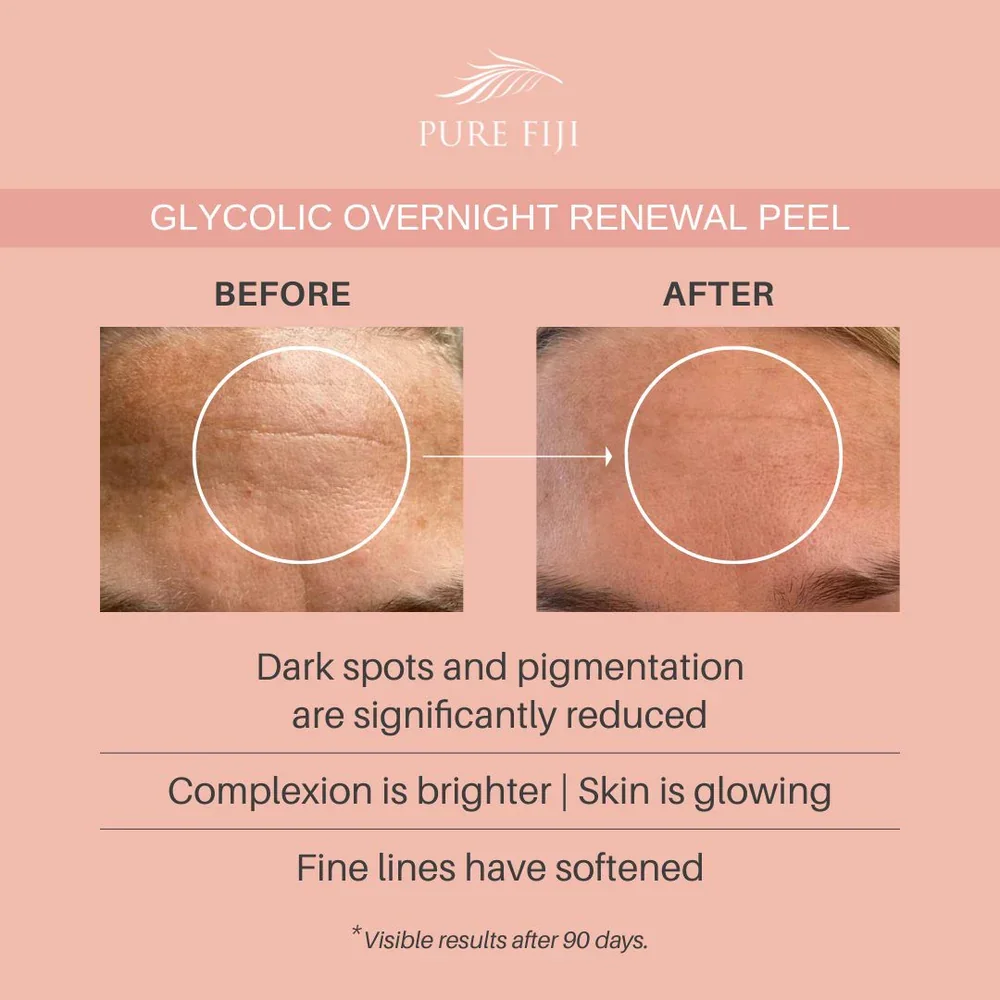 glycolic-overnight-renewal-square-4_1000x.webp