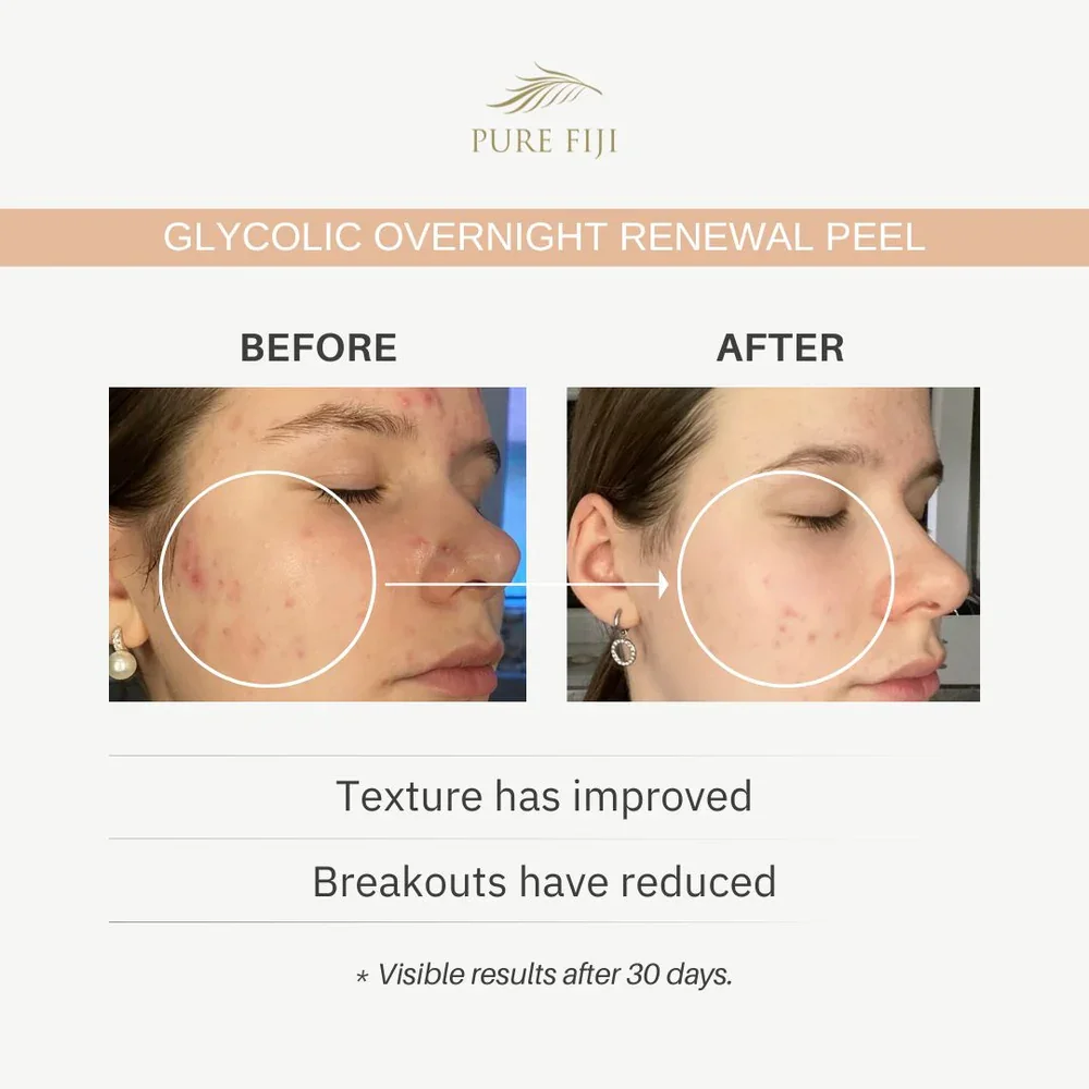 glycolic-overnight-renewal-square-5_1000x.webp