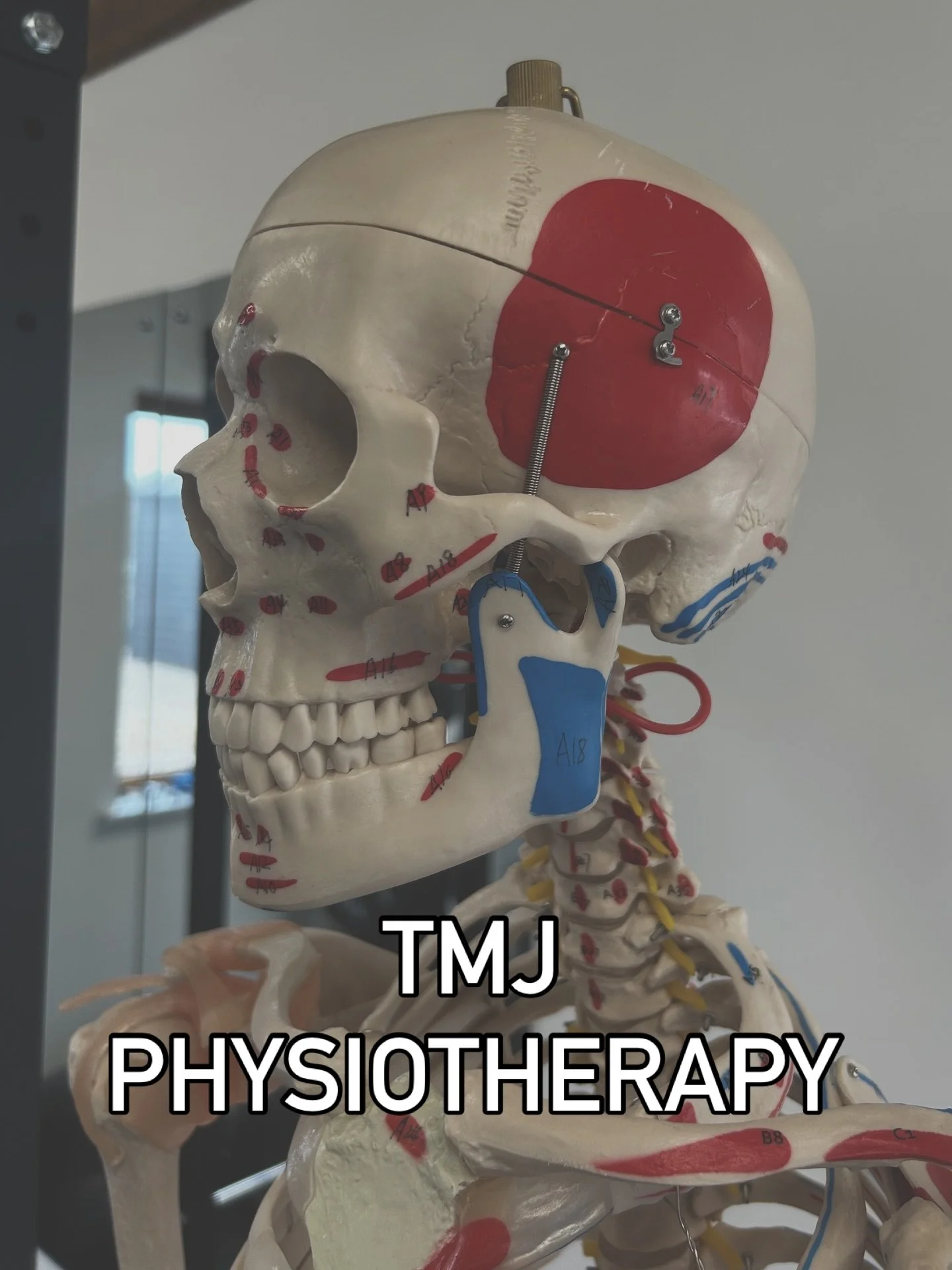 🌿 JAW PAIN 🌿

Jaw pain? Headaches? Clicking when you chew?
It might be your TMJ 👇

The temporomandibular joint (TMJ) connects your jaw to your skull &mdash; and when it&rsquo;s not moving properly, it can cause:
✔️ Jaw pain
✔️ Headaches &amp; migr