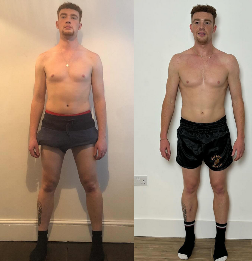 Billy, muscle mass and gait improvements. 3 years FP training. Before: knee pain 6/10, hyperextended. After: knee pain 0/10, not hyperextending knees.