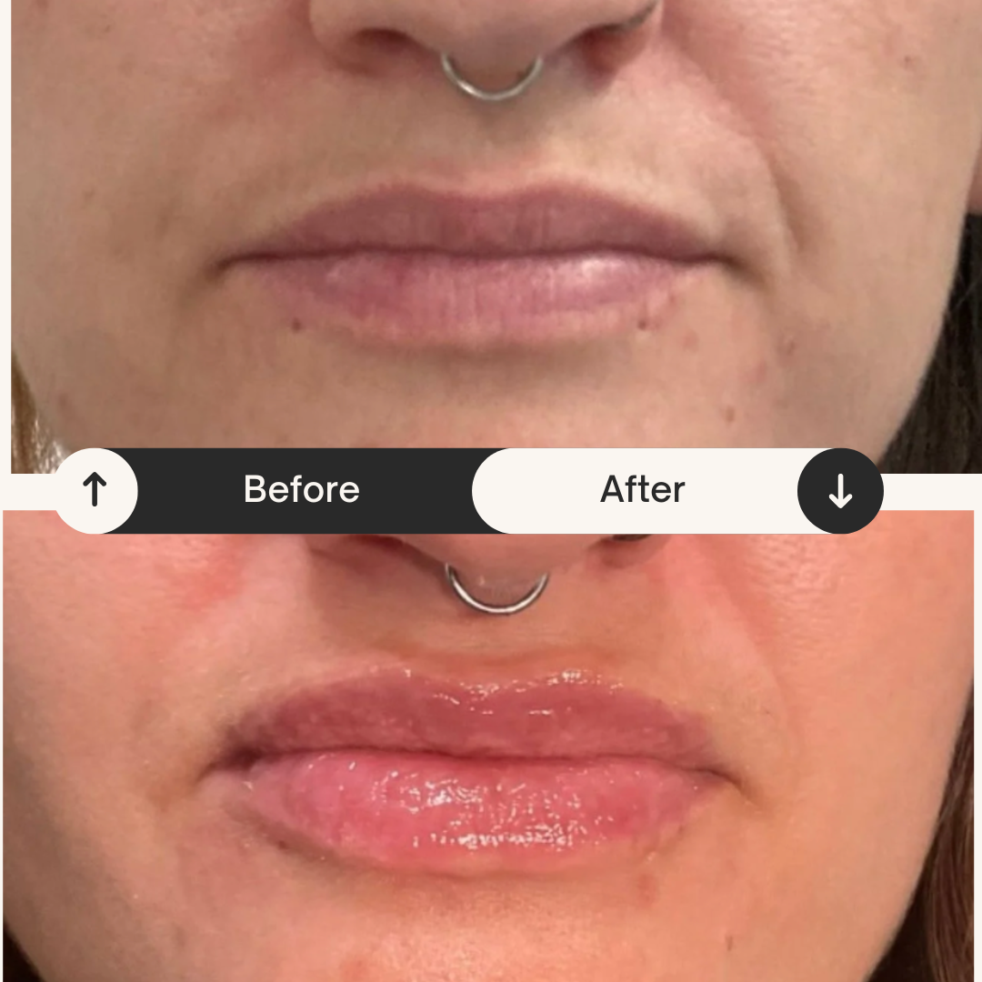 Comparison of lips before and after applying a gloss or moisturizer, showing shinier, more hydrated lips in the after image.