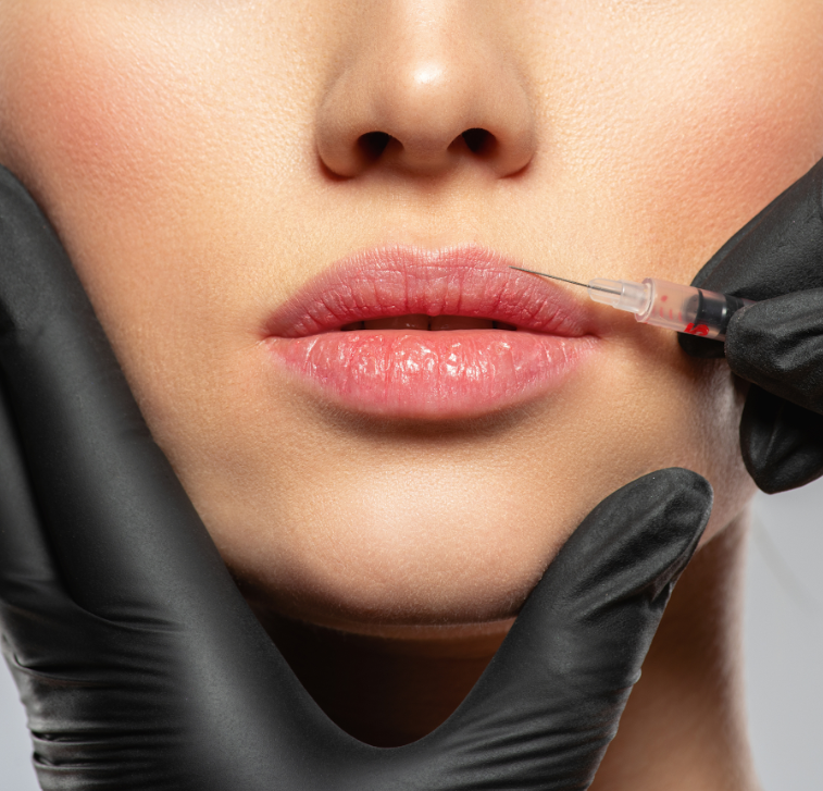 A person receiving lip injections in a clinical setting, with a healthcare professional wearing black gloves preparing to inject a cosmetic filler into the upper lip.