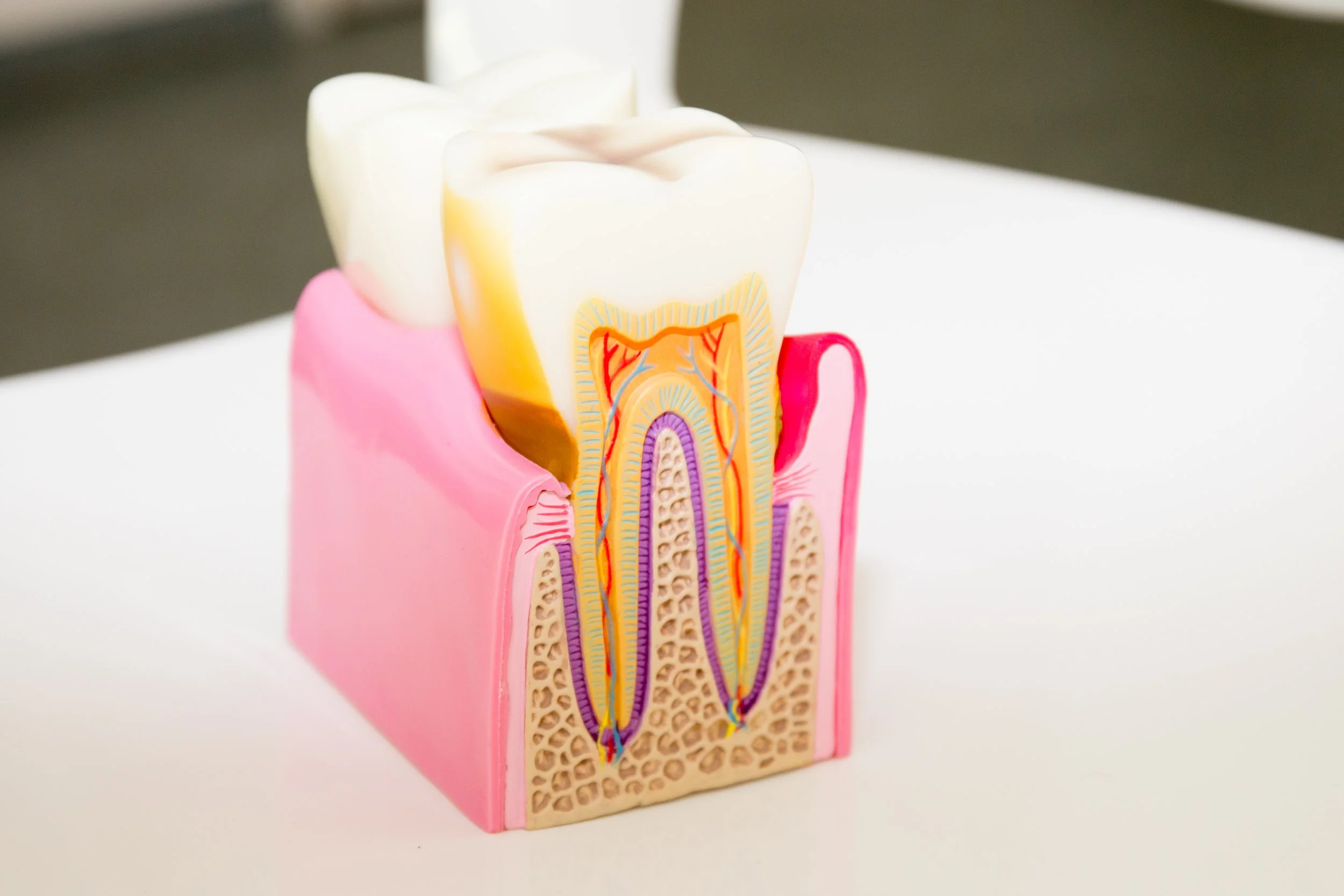 root canal boynton beach