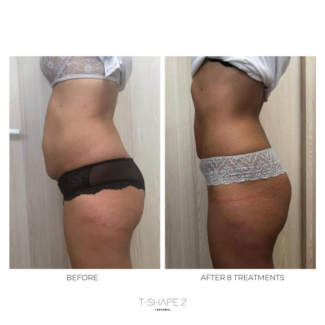 After-8-treatments-2.jpg