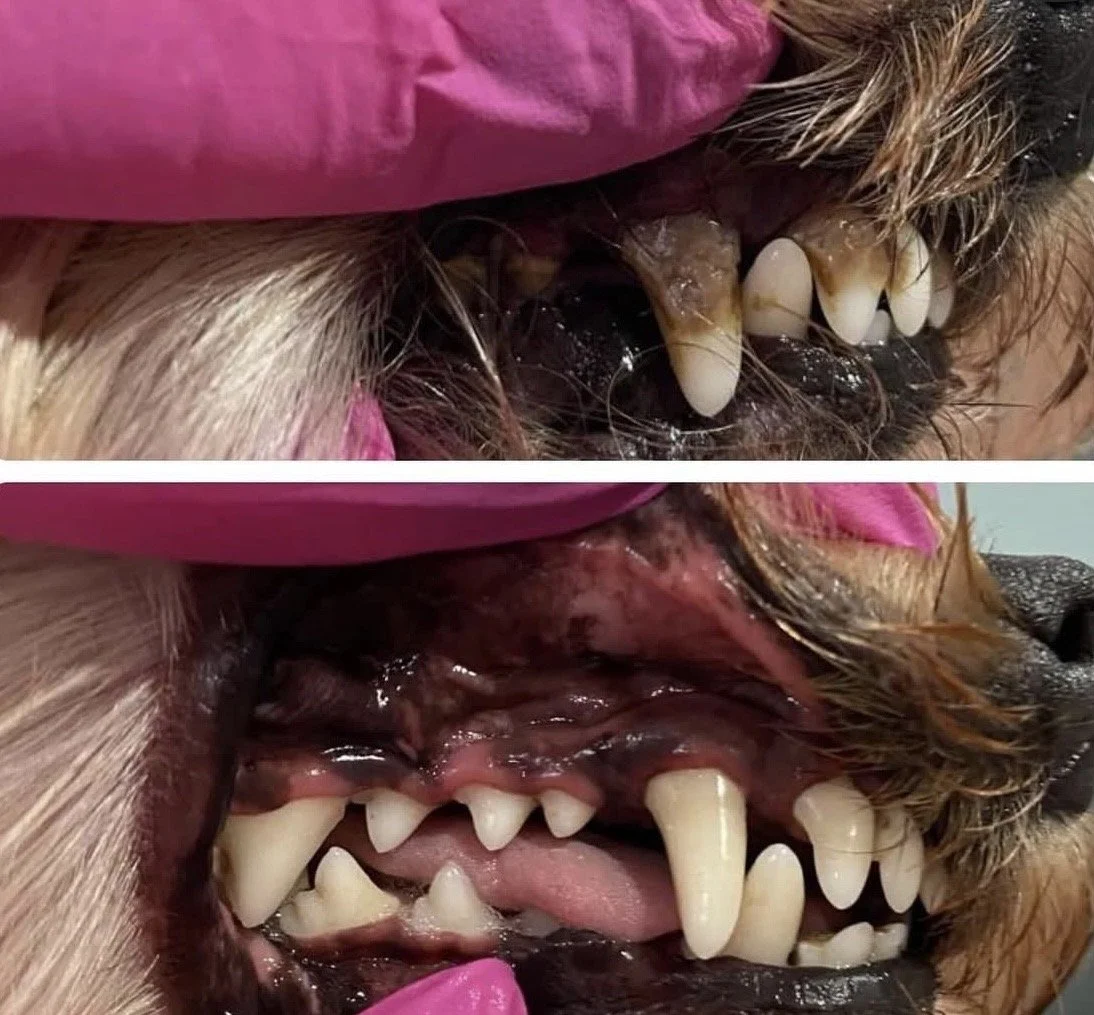 ULTRASOUND TEETH CLEANING