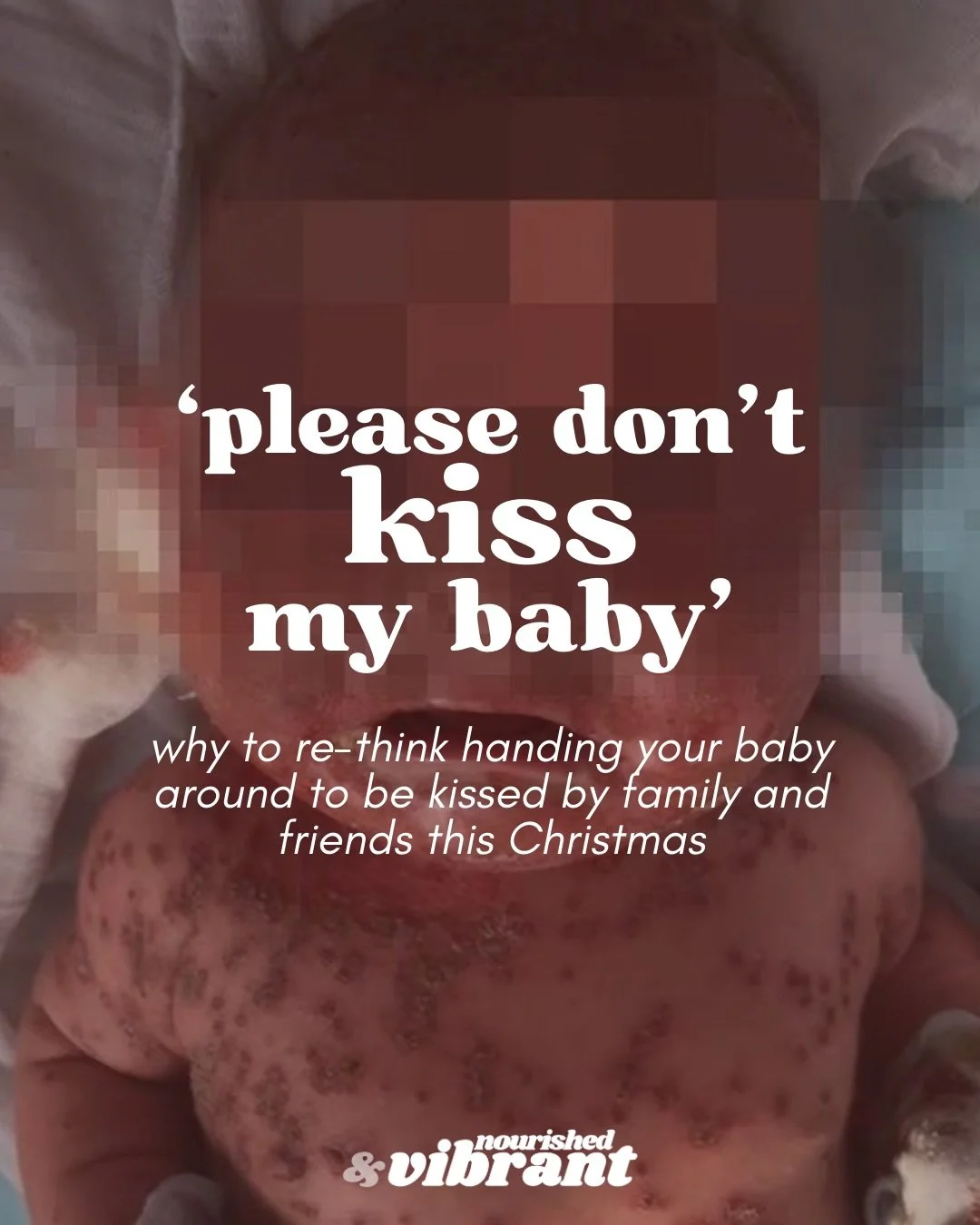 💋Comment KISS for 4 x other threats and toxins I recommend avoiding for babies. 

👶 A kiss can be sweet&hellip; but for a newborn, it can also be dangerous. 💔

Cold sores (HSV-1) can be life-threatening to babies in their first weeks of life even 