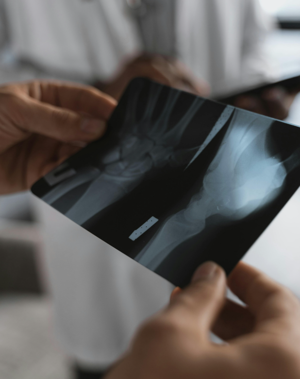 How to Minimise Effect from Xrays