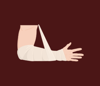 Natural Support for Broken Bones