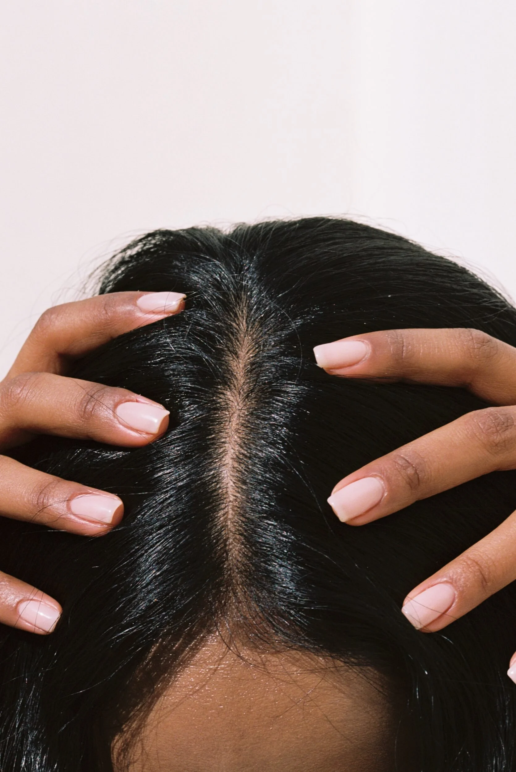 Scalp Health Matters: When It’s Time to See a Dermatologist for Your Hair and Scalp