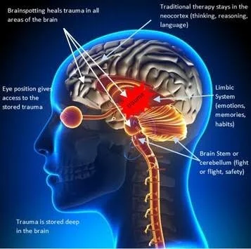 Diagram showing how trauma is stored deep in the brain and can be healed through brainspotting, which heals trauma across all brain areas, using traditional therapy in the neocortex and limbic system, and stressing the importance of the brain stem or cerebellum for safety.