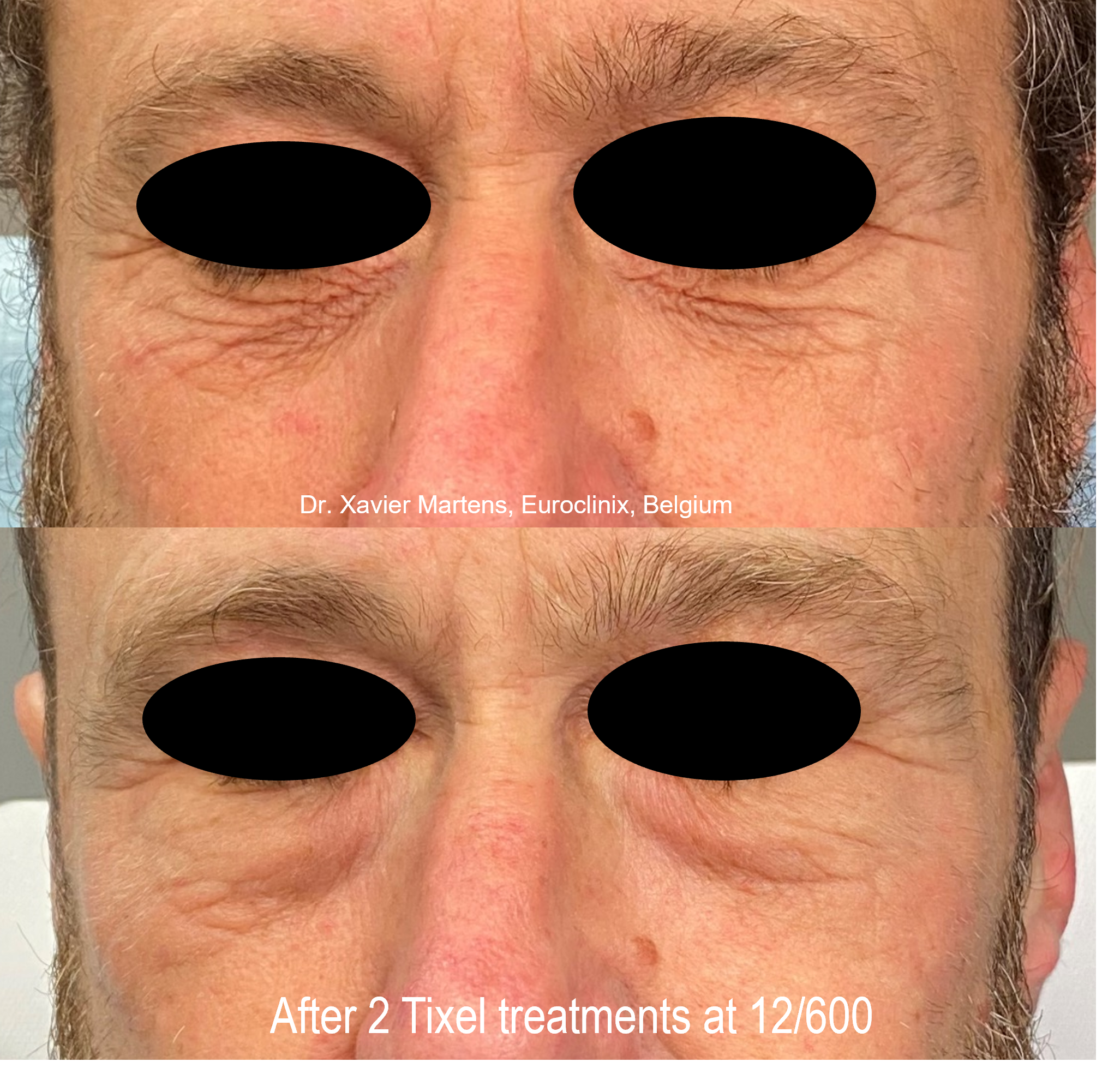 Male before and after.png