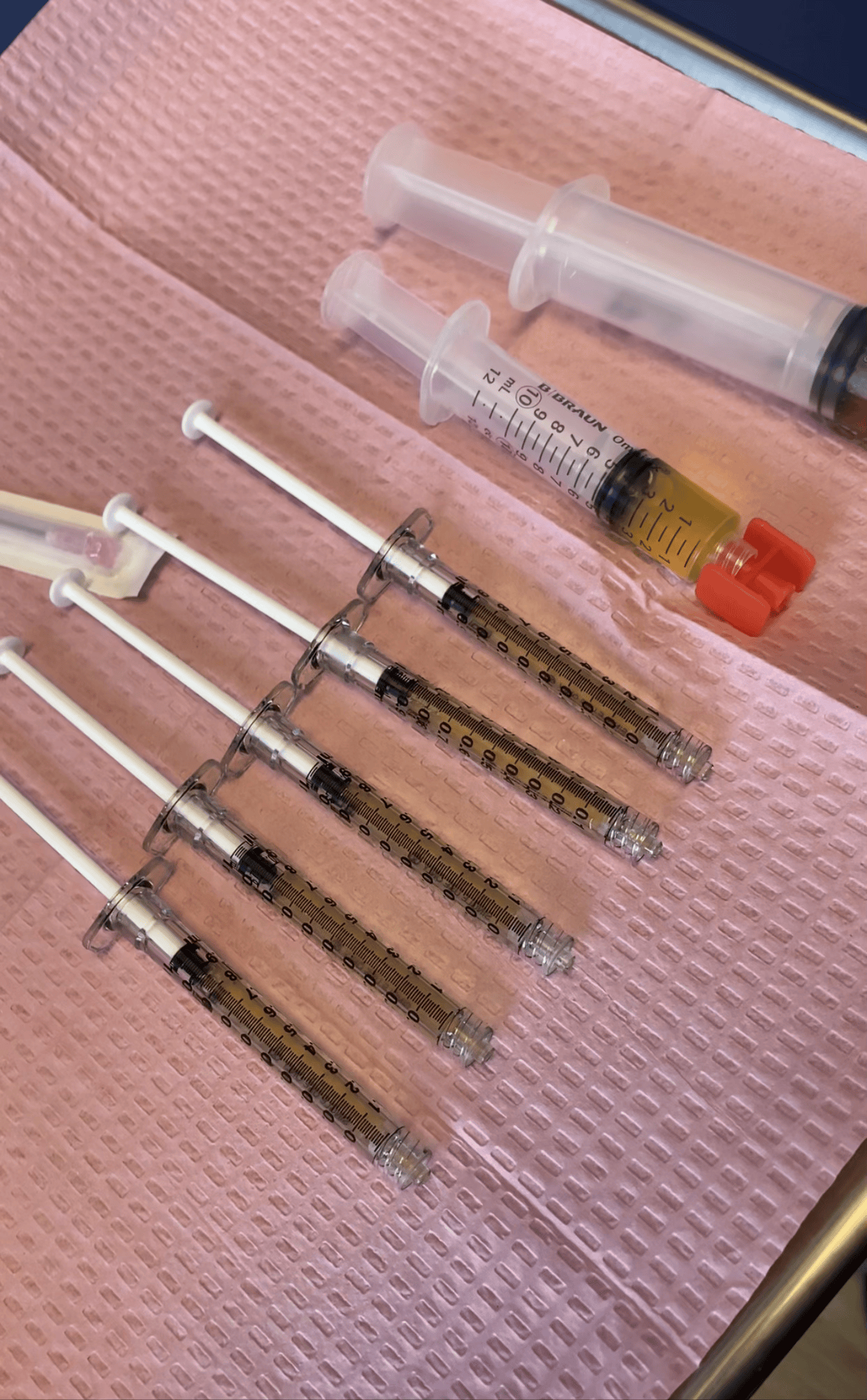 PRF Facial Injections