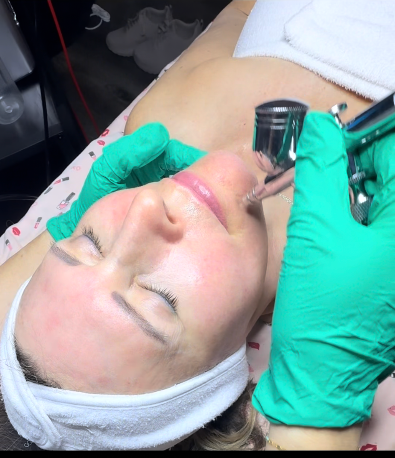 Hydra facial
