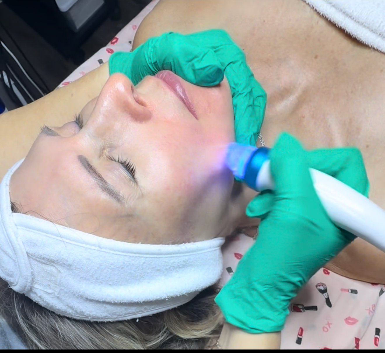 Hydra facial