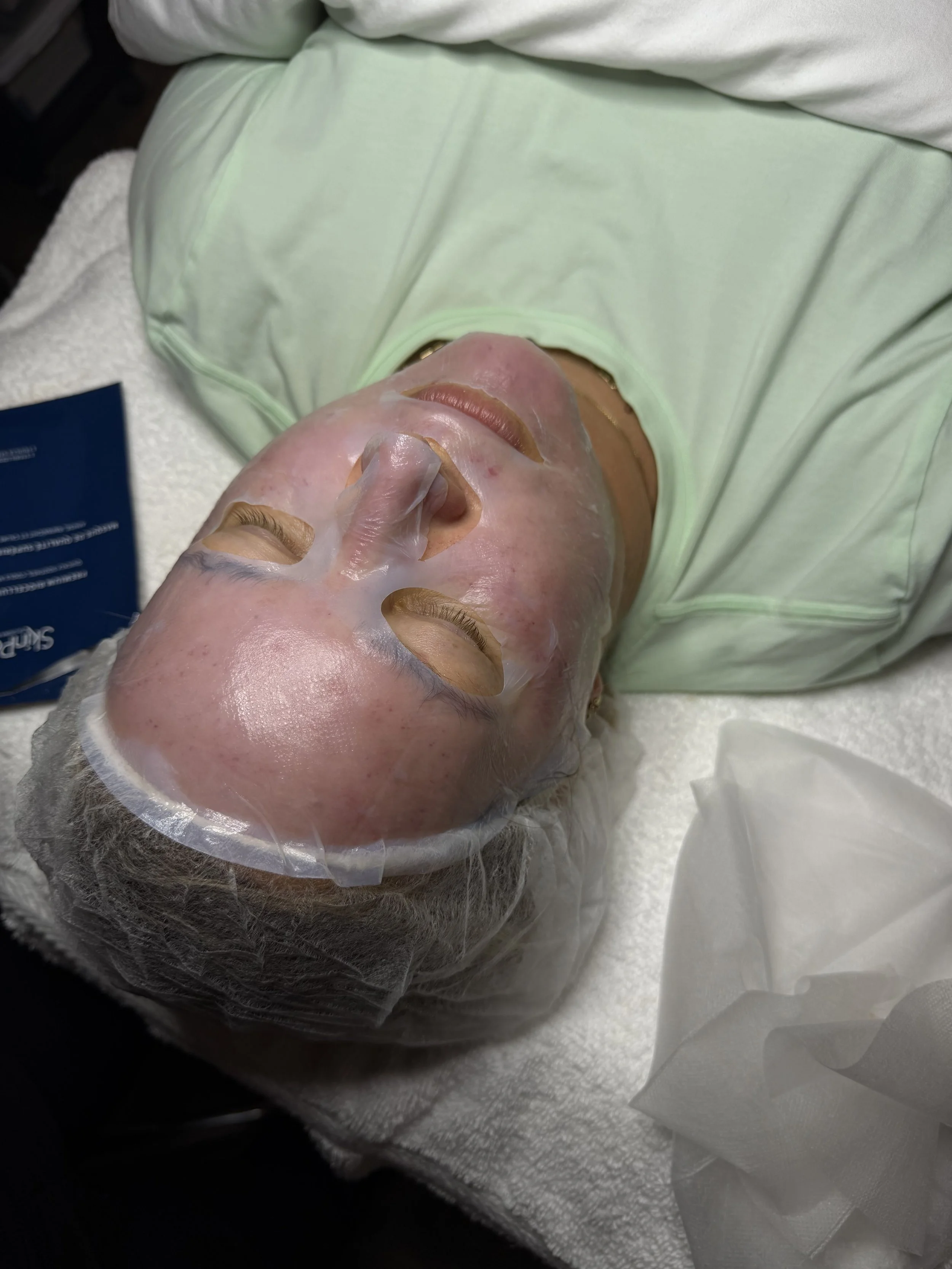 Microneedling with SkinPen