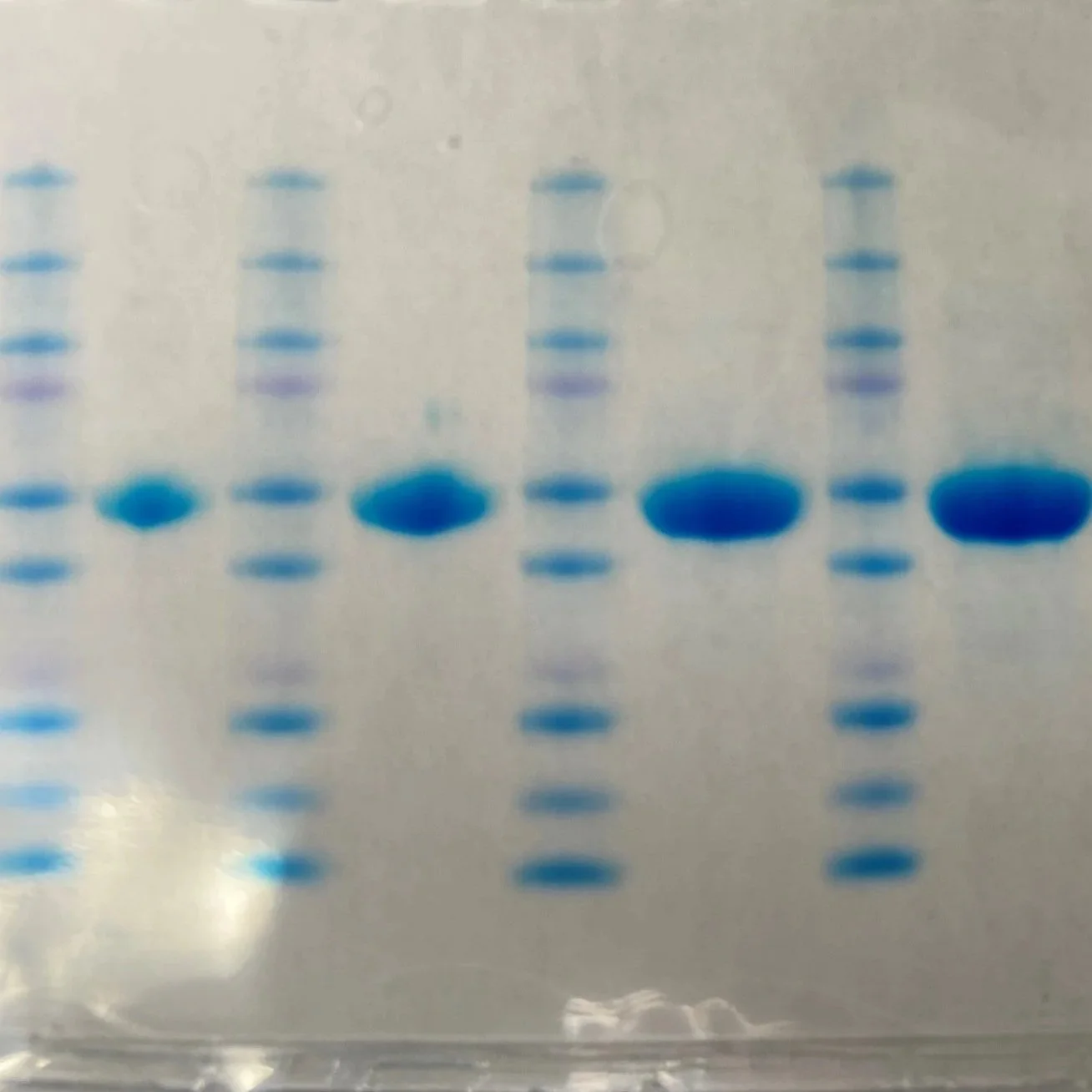 Coomassie-stained protein gel