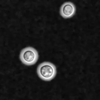   Cryptococcus neoformans 