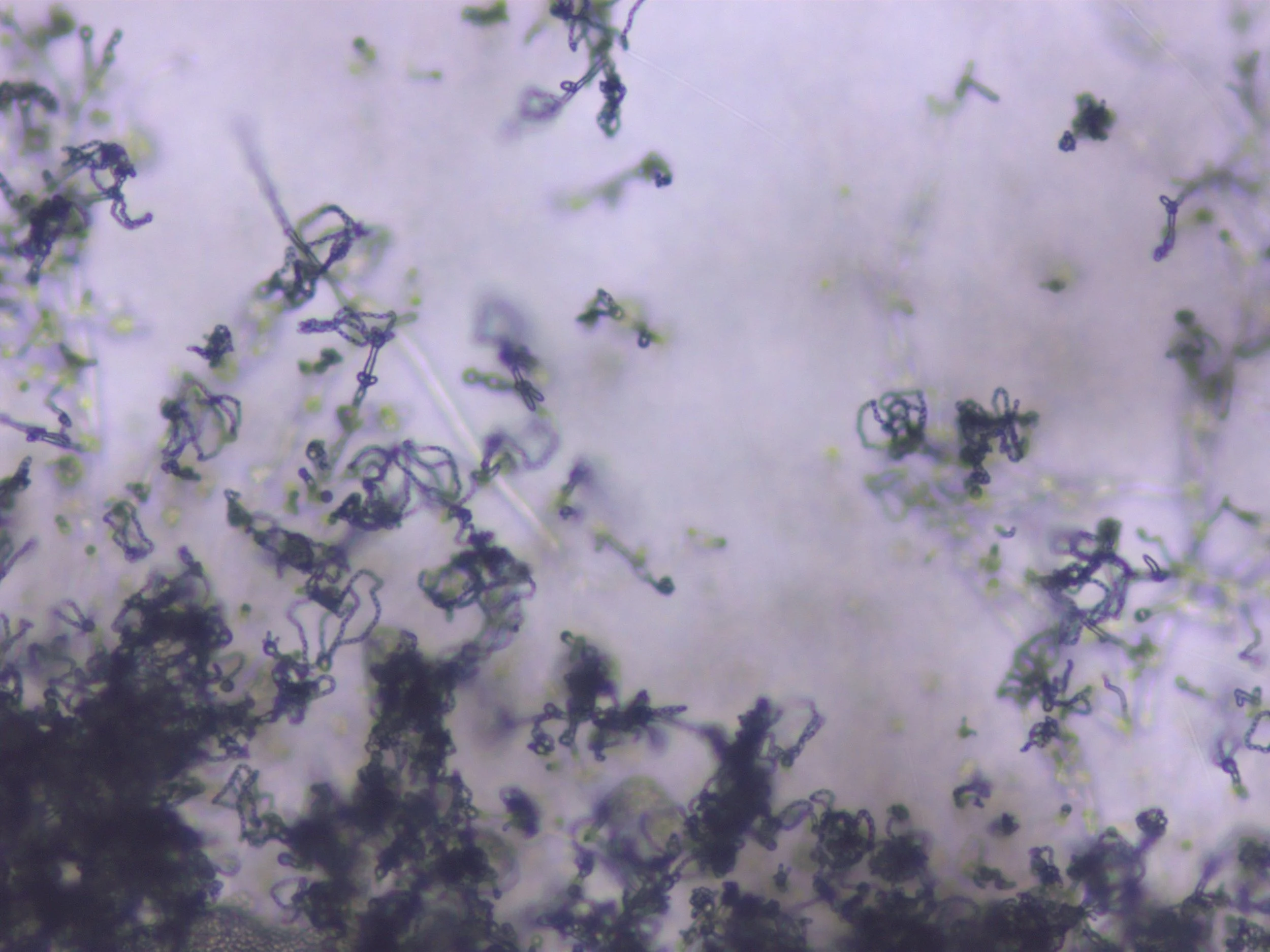   Cryptococcus neoformans  spores 