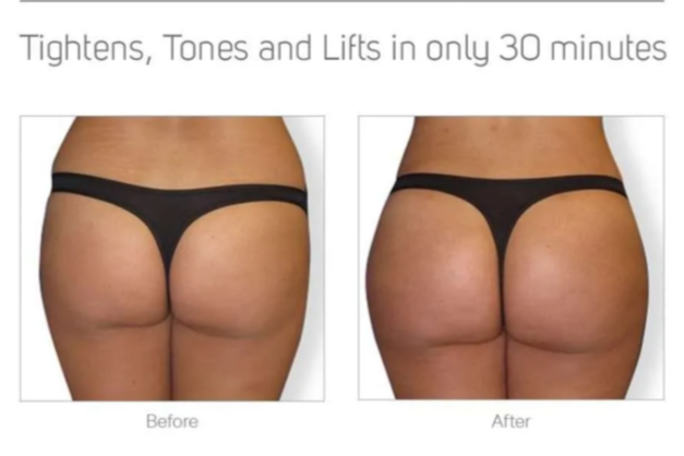 Comparison of a woman's buttocks before and after a 30-minute workout, showing tightening, toning, and lifting results.