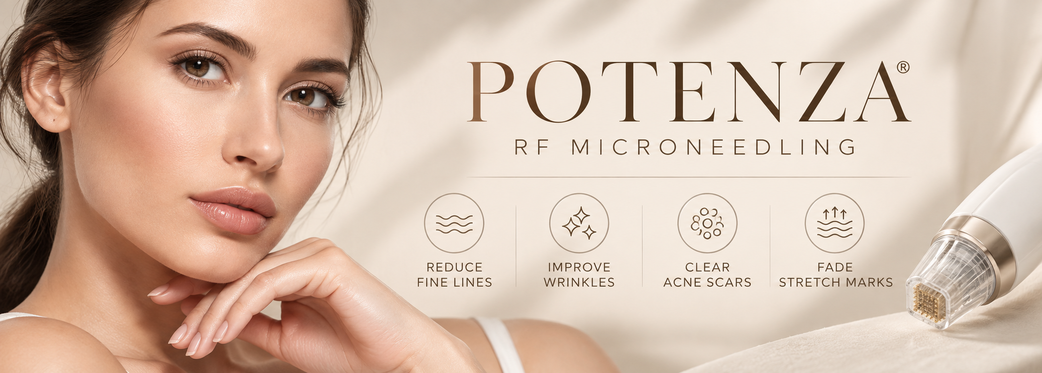 A woman with flawless skin near the text 'Potenza RF MicroNeedling' advertising a skincare treatment. The image shows icons and benefits such as reducing fine lines, improving wrinkles, clearing acne scars, and fading stretch marks, with a micro-needling device on the right side.