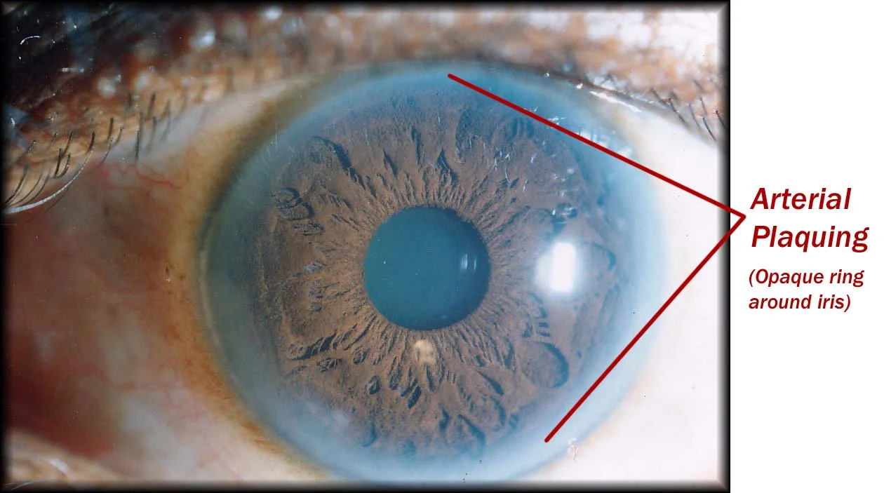 iridology.jpg