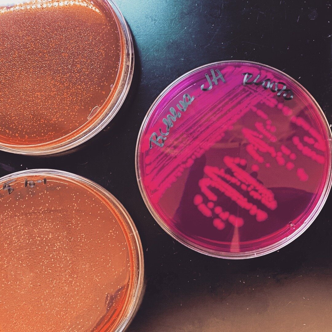 Pretty in pink? A few of our favorite microbes!
