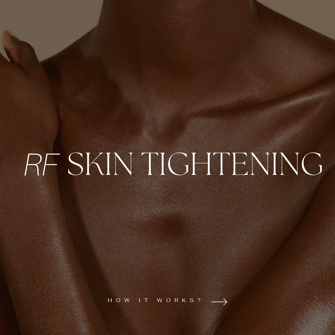 Radio Frequency&nbsp;Skin Tightening&nbsp;can help you to turn back the clock to restore your skin&rsquo;s bounce and youthfulness! 
A non surgical &amp; non invasive alternative with instant benefits 🫶🏽

Link in bio to book now 🤍

#rfskintighteni