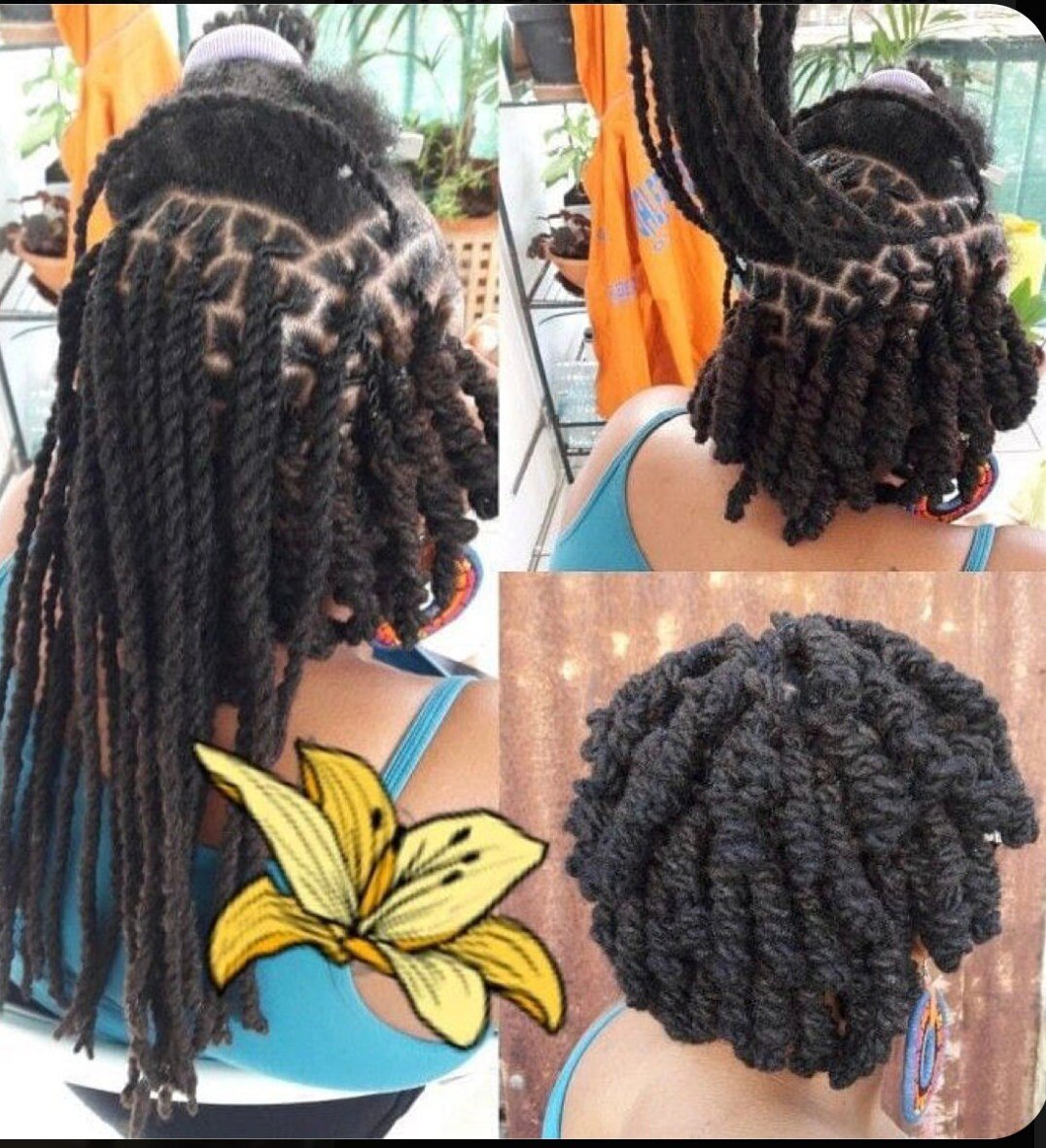 Scalp 5 piece Hair Kit Treatment
