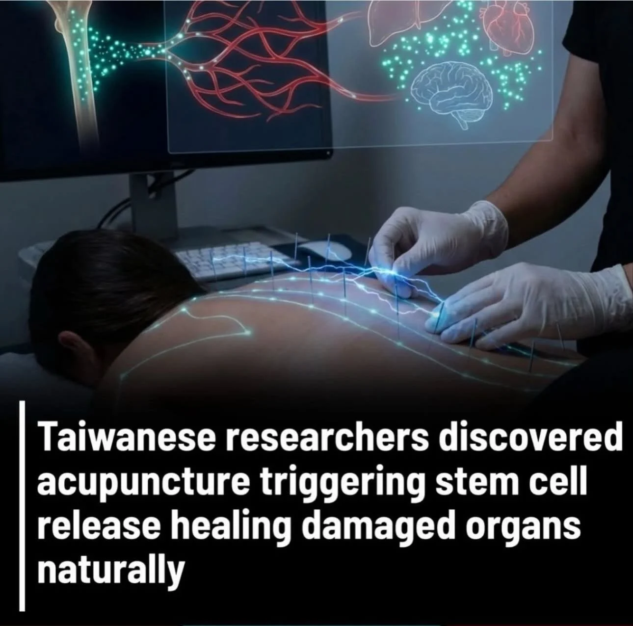 Taiwanske forskere oppdaget akupunktur som utl&oslash;ser stamcellefrigj&oslash;ring helbredende skadede organer naturlig. Forskere ved China Medical University fant at elektroakupunktur ved spesifikke meridianpunkter stimulerer beinmarg til &aring; 