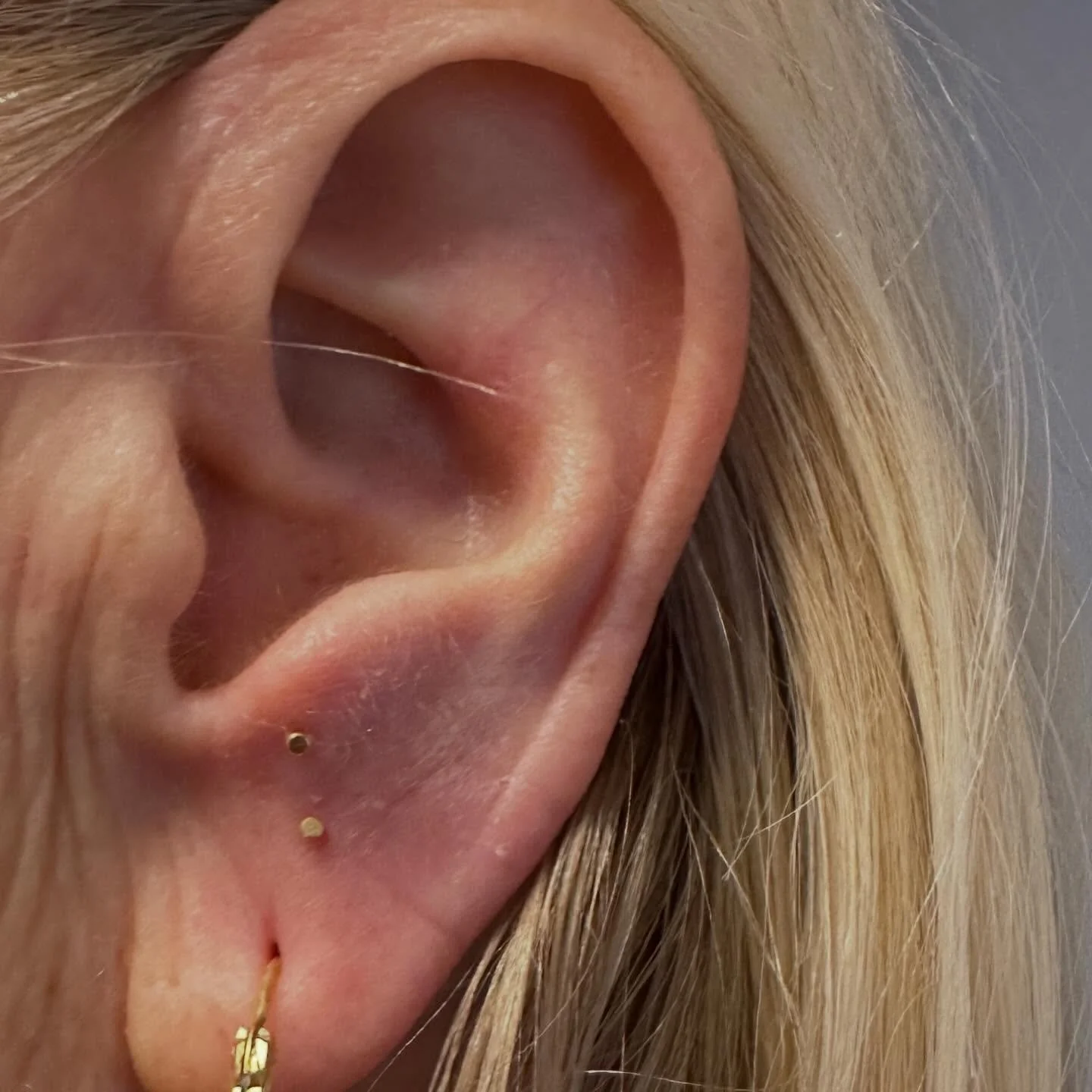 Permanente n&aring;ler i gull er her plassert i &oslash;ret for lengre og sterkere effekt utover  selve akupunkturtimen. Her behandle omr&aring;det for pannen og &oslash;ynene. Akupunkturn&aring;len eller piercingen kan sitte i en uke, men den faller