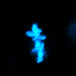 Physical progression of chromosome (cyan) segregation and de-condensation in mitotic mESCs (zoom-in view). How much force does it take?