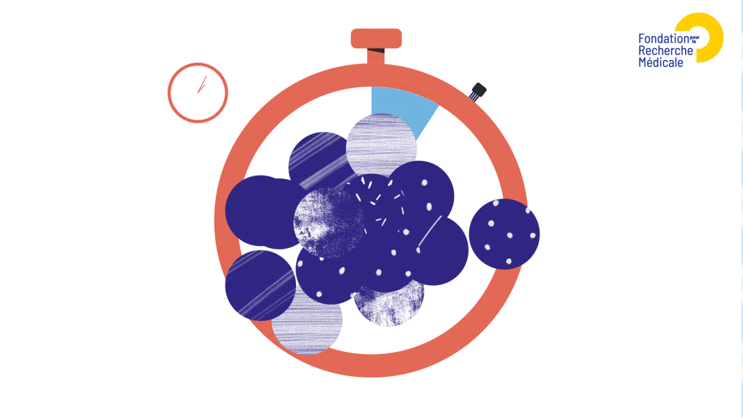 FRM - C'est quoi le cancer ? - temps qui passe - réalisation Capucine Bertin