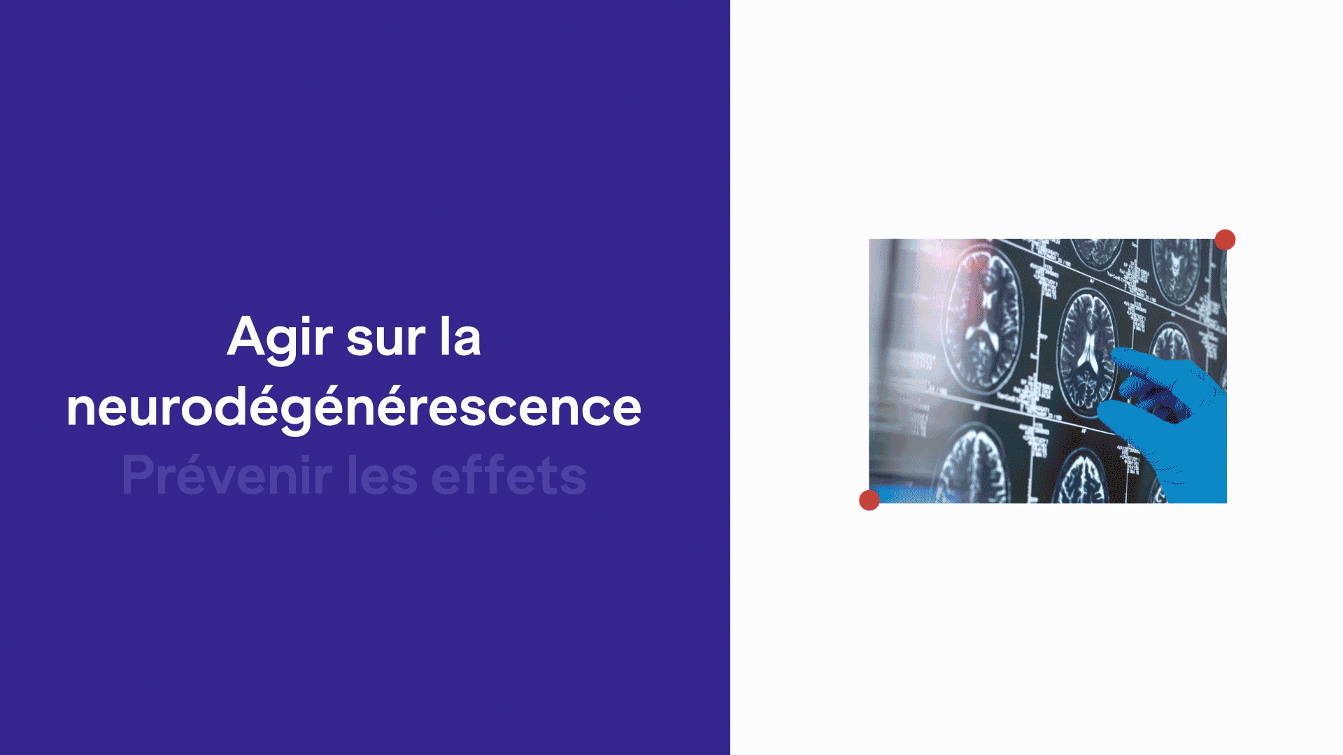 FRM - recherche médicale sujets