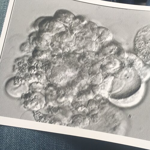 Microscopic view of a cluster of cells or microorganisms attached to a surface.