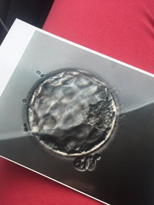 Photograph of a microscopic image of a human egg cell with a fertilized embryo inside, on a piece of paper.